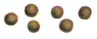 Bristol stool chart Type 1: separate hard lumps, like nuts